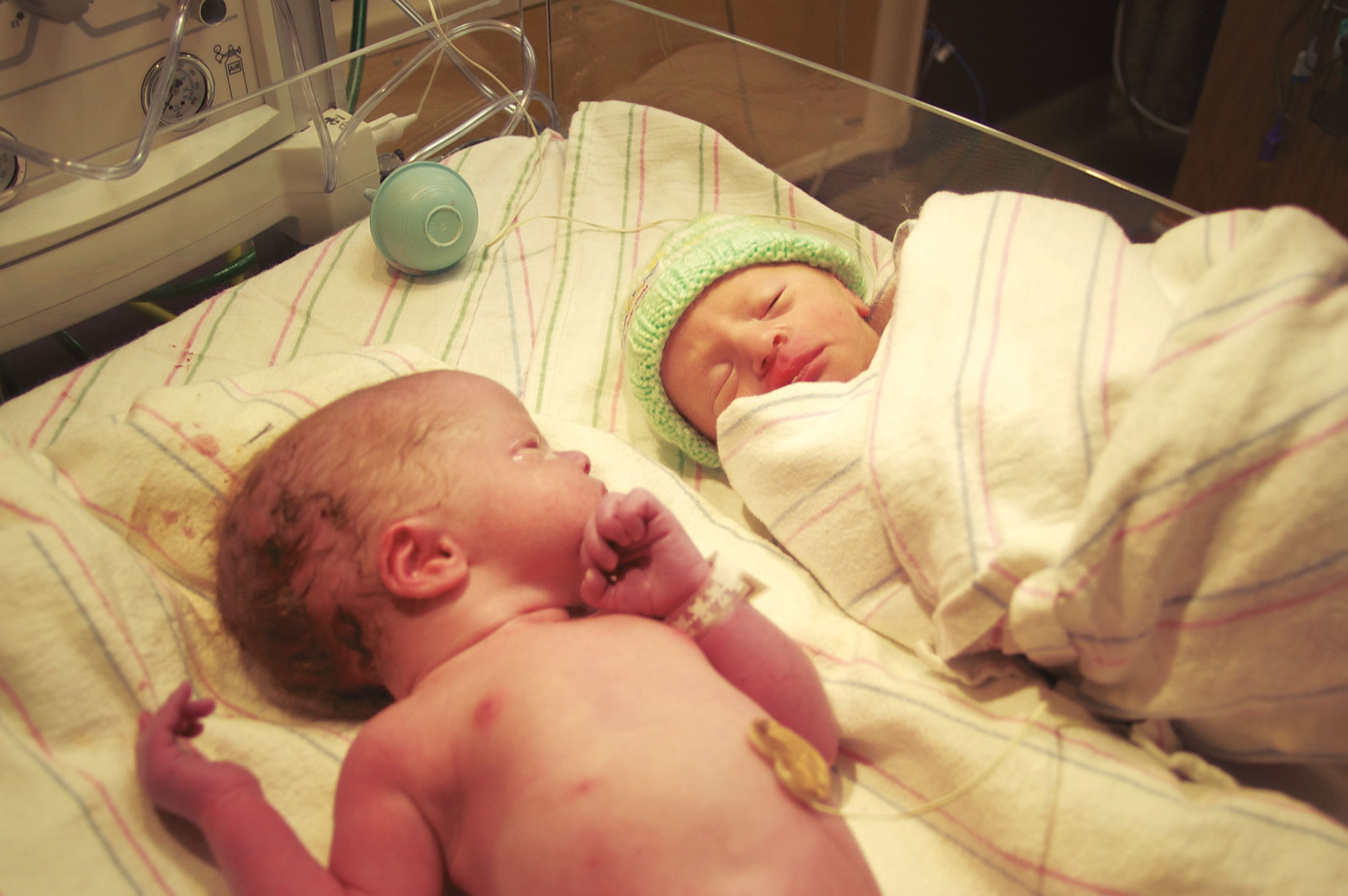 Dos gemelos después de nacer. Fotografía de Jeremy Talcott