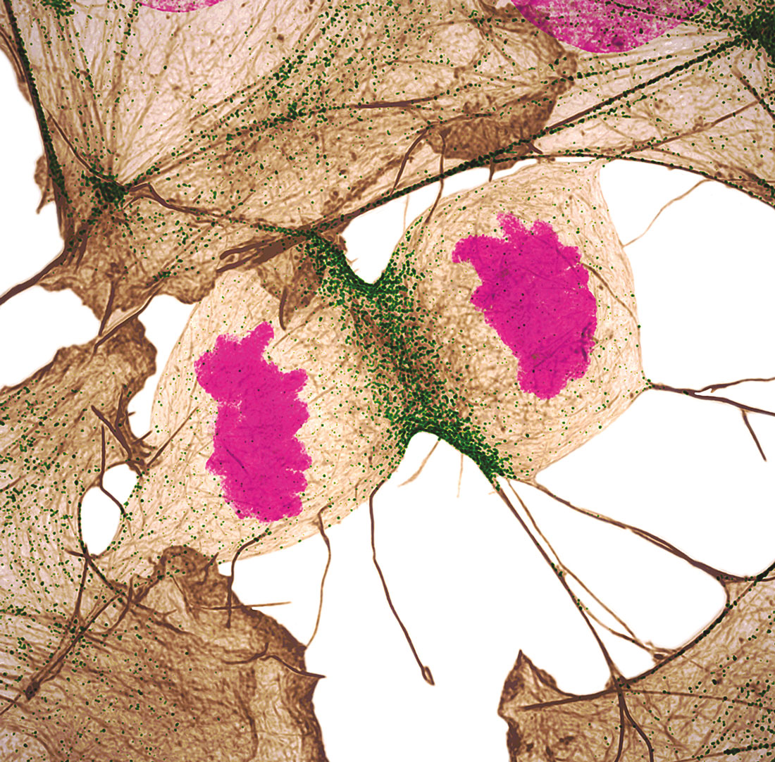 Fibroblasto humano realizando división celular, Nilay Taneja y Dylan T. Burnette, Vanderbilt University School of Medicine