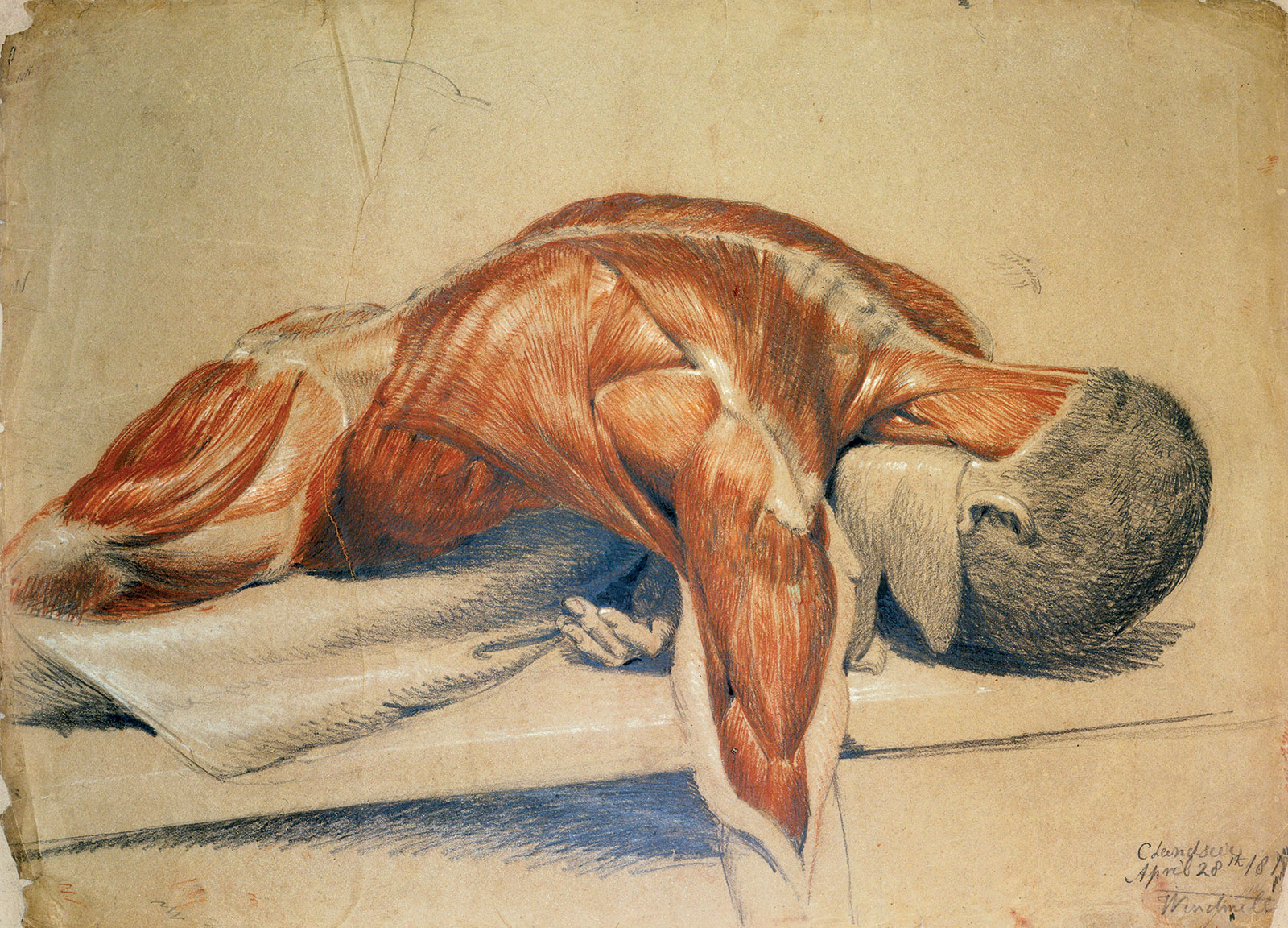  Charles Landseer, cuerpo desollado, 1813. Wellcome Collection