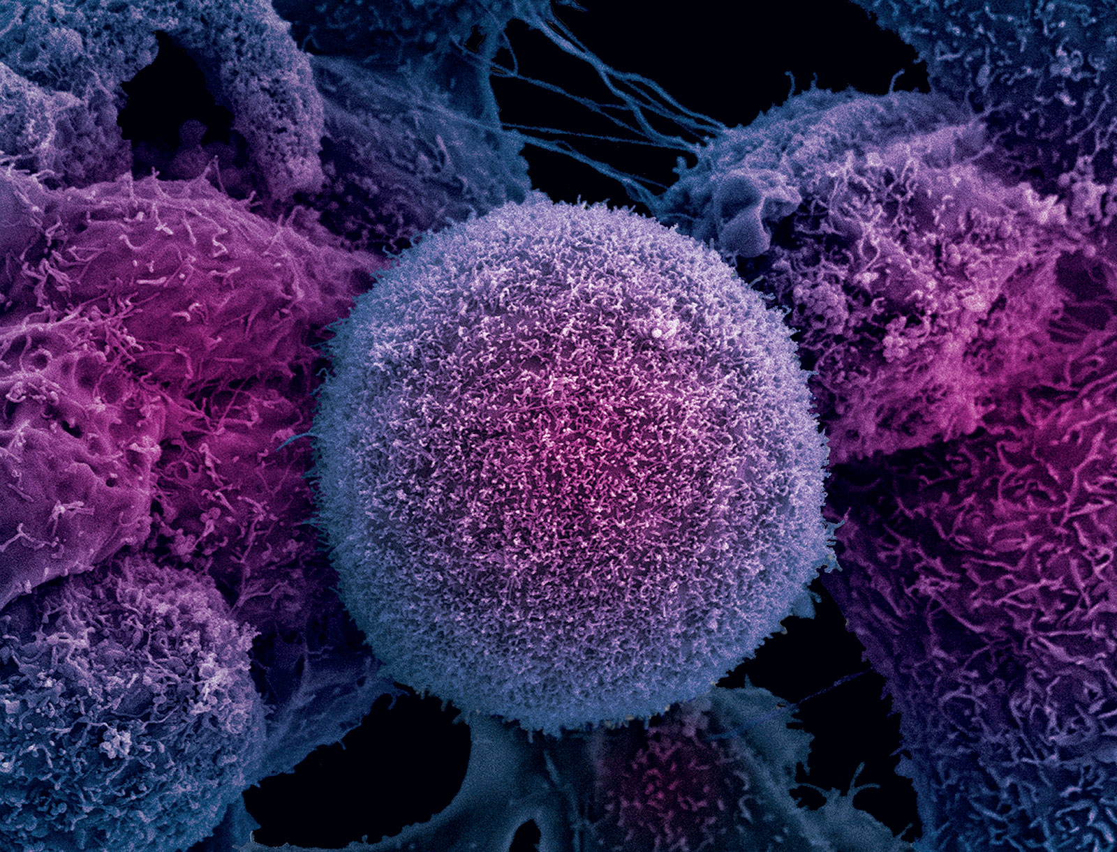 Células de cáncer de próstata. Anne Weston, The Francis Crick Institute. Wellcome Collection 